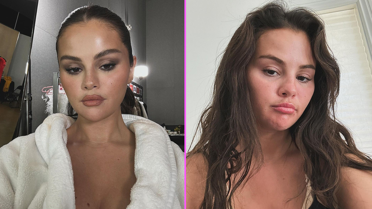 Selena Gomez tratamientos estéticos