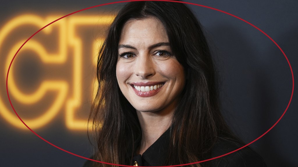 Anne Hathaway disculpa entrevista