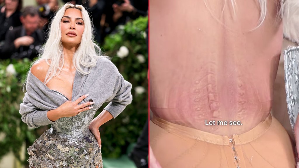 destacada-kim-kardashian-daño-corset.jpg