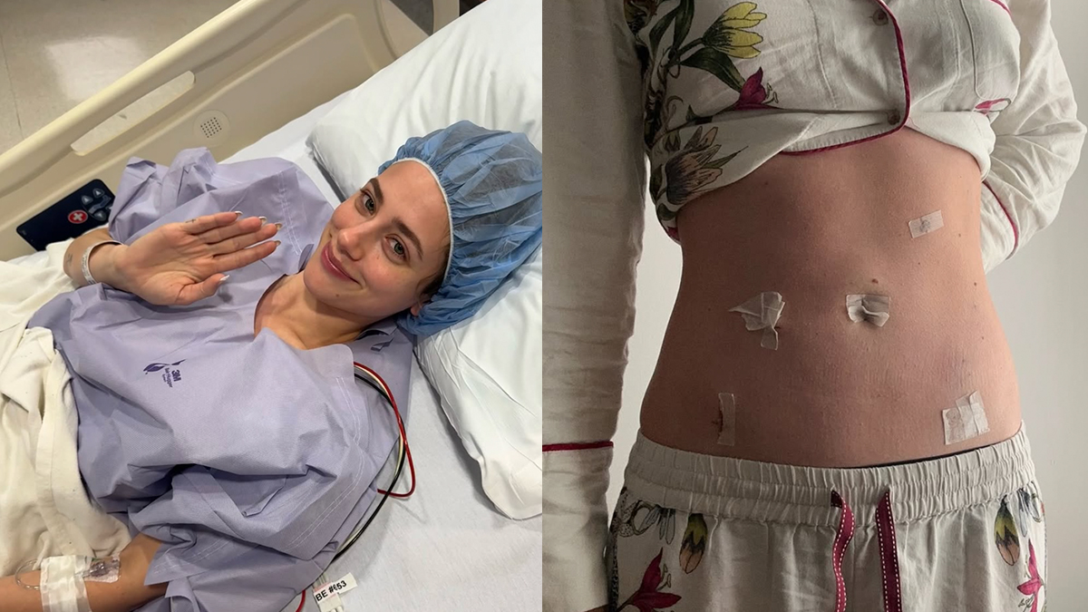 lili-reinhart-endometriosis